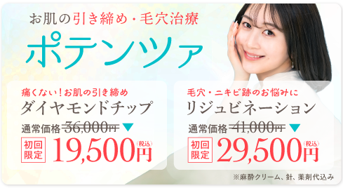 ポテンツァ(ダイアモンド)