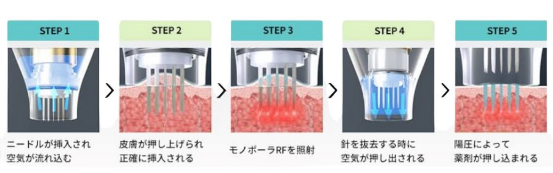 ドラッグデリバリーシステム
