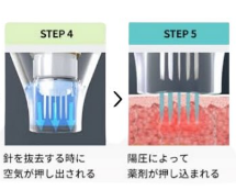 ドラッグデリバリーシステム