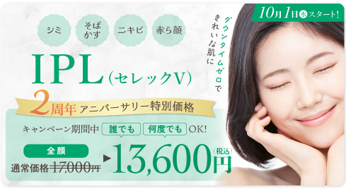 IPL(セレックV)